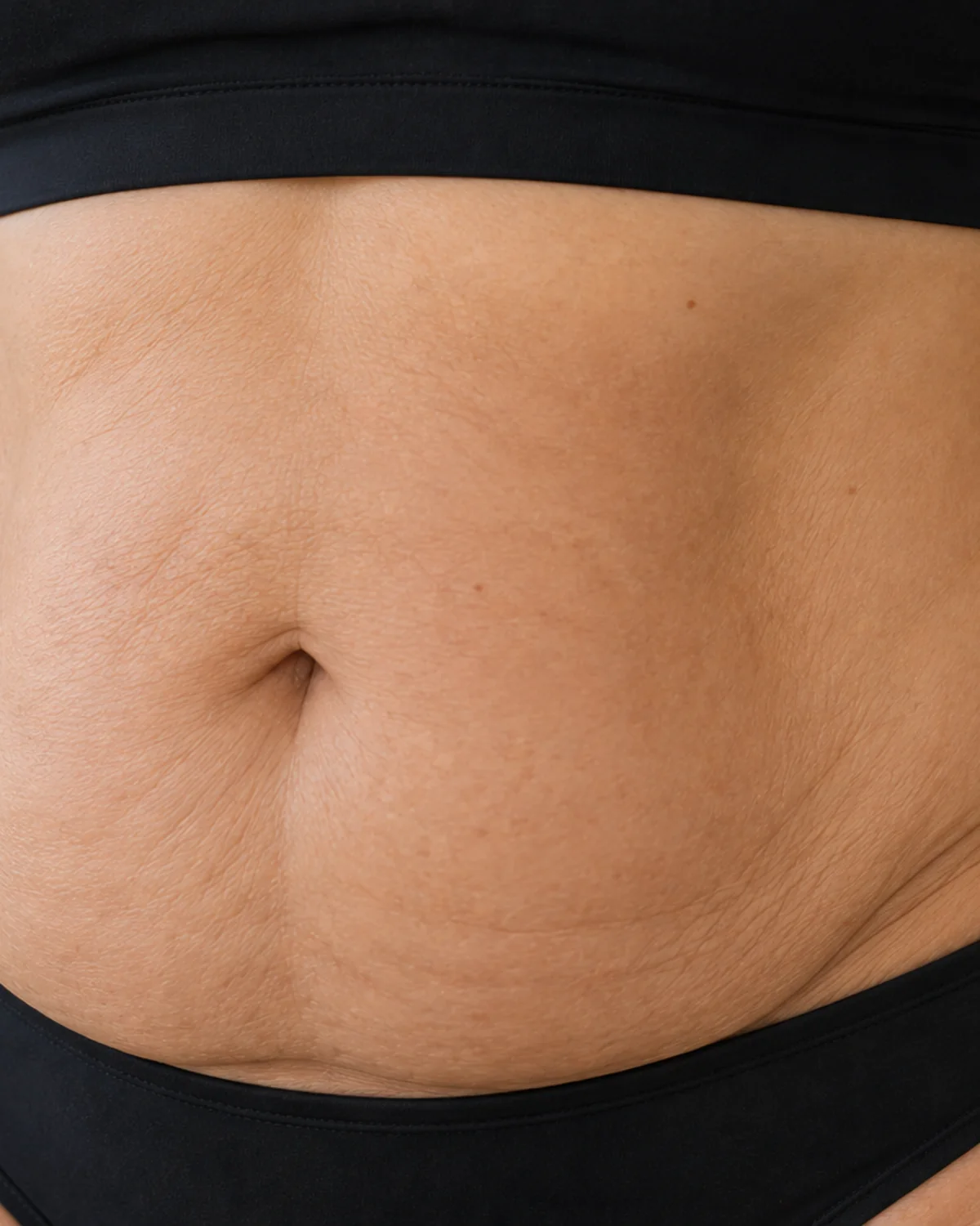 Muscle Tone Loss