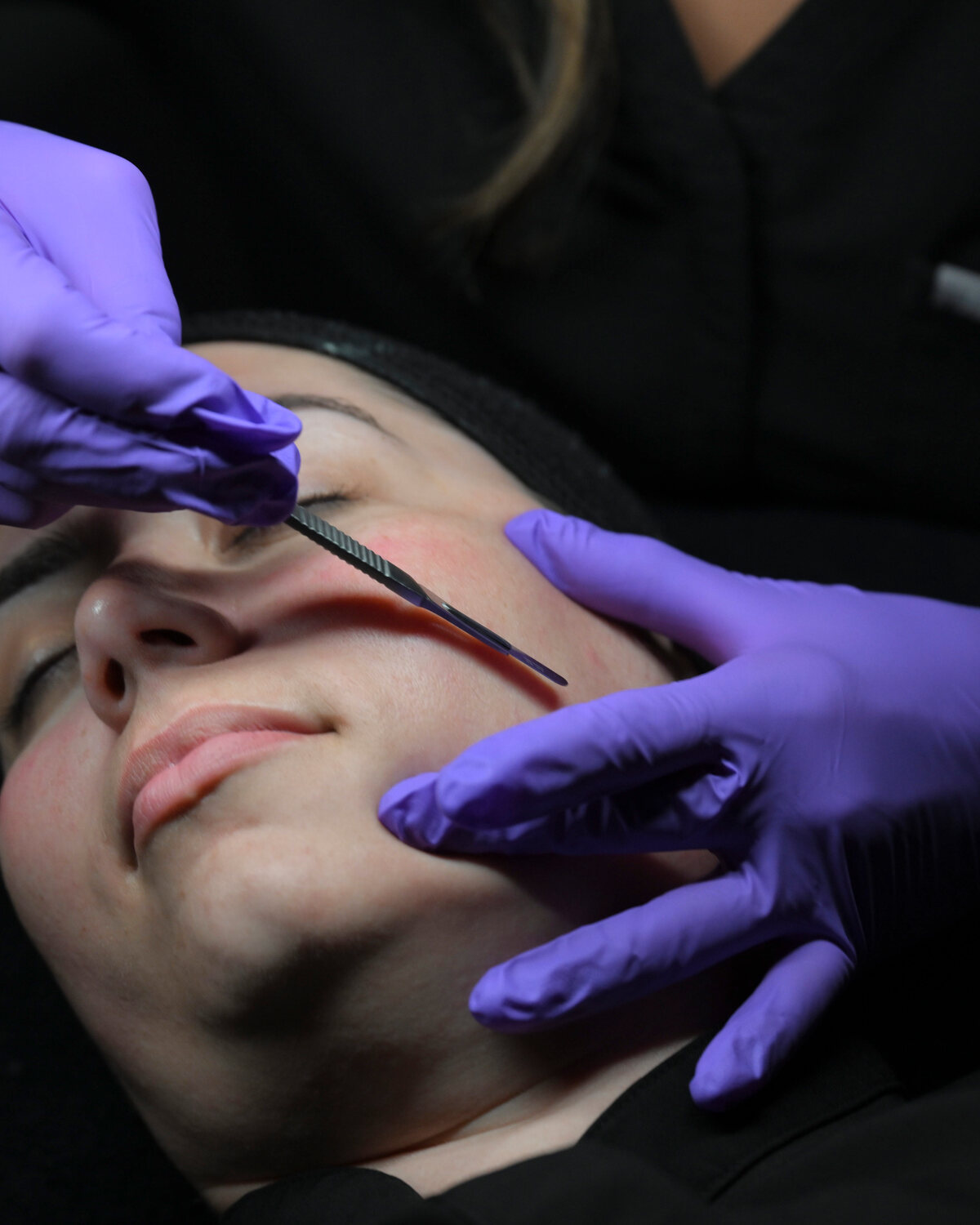 Dermaplane Facial