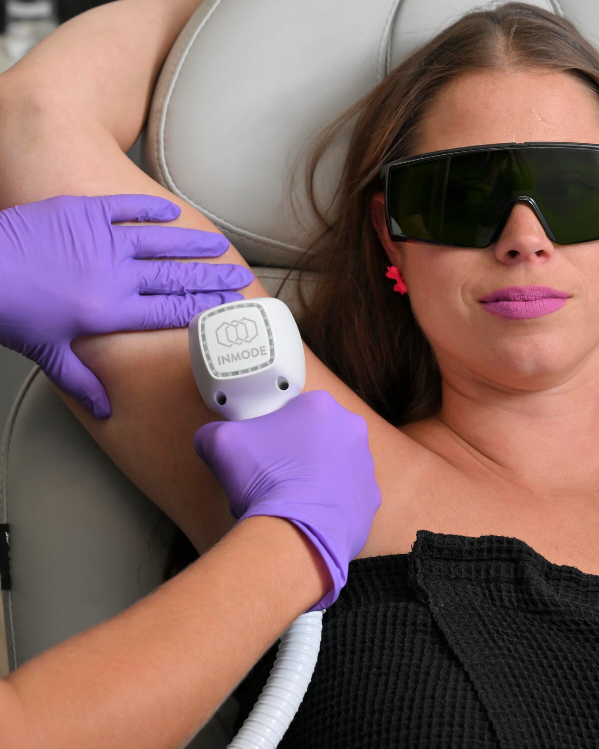 Laser Hair Removal